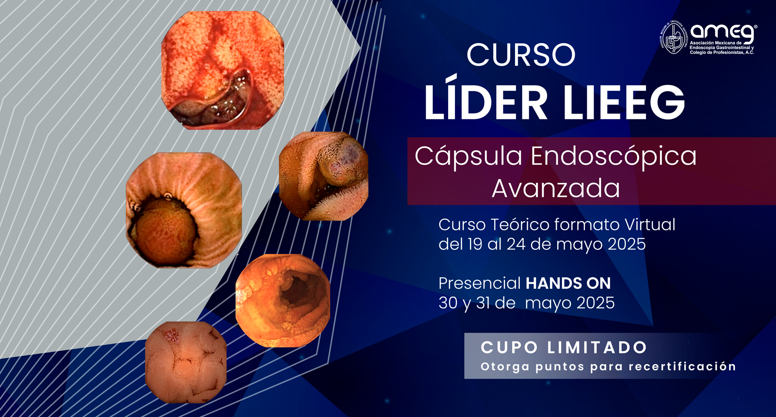 Curso LIEEG: Curso Internacional de Videocápsula Endoscópica: enfoque teórico-práctico basado en evidencia y estándares de calidad