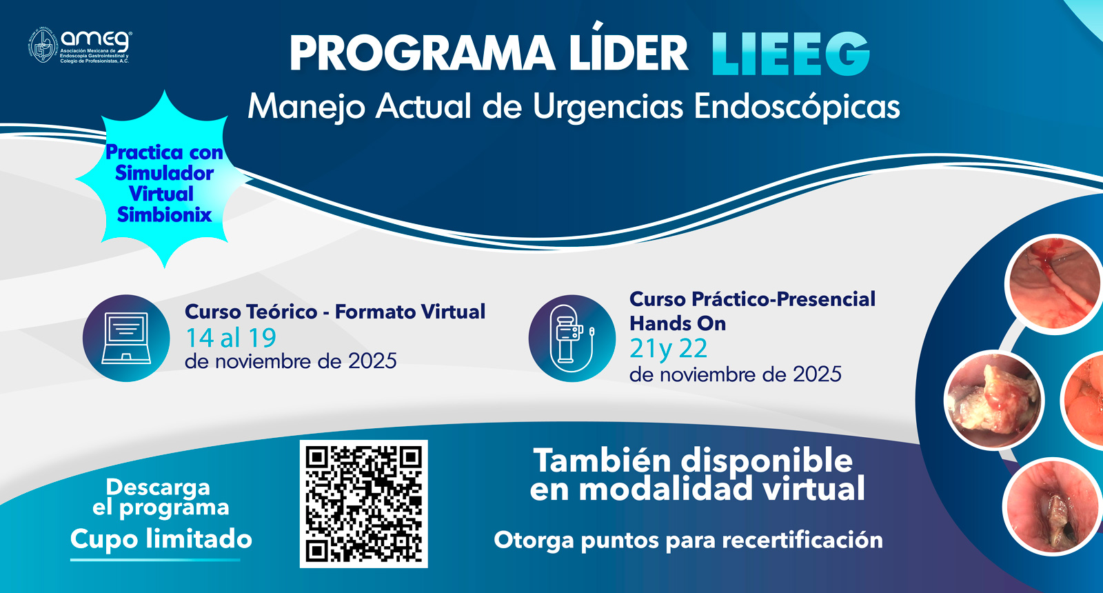 Curso LIEEEG Urgencias Endoscopicas